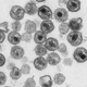 HIV viral particles under an electron microscope.